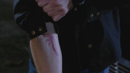 Ouch! Ouch!